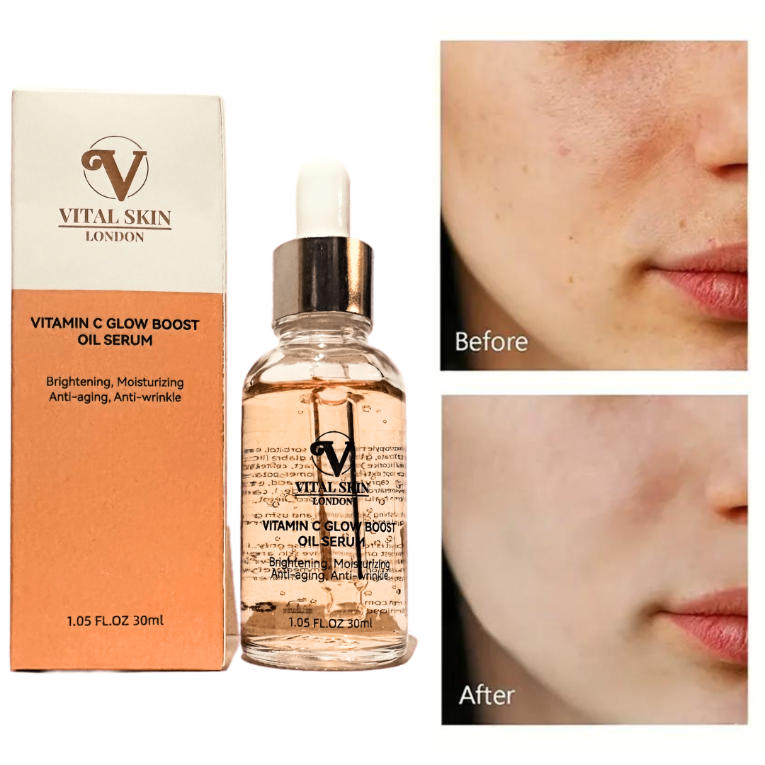 Vitamin C Glow Serum – 30ml